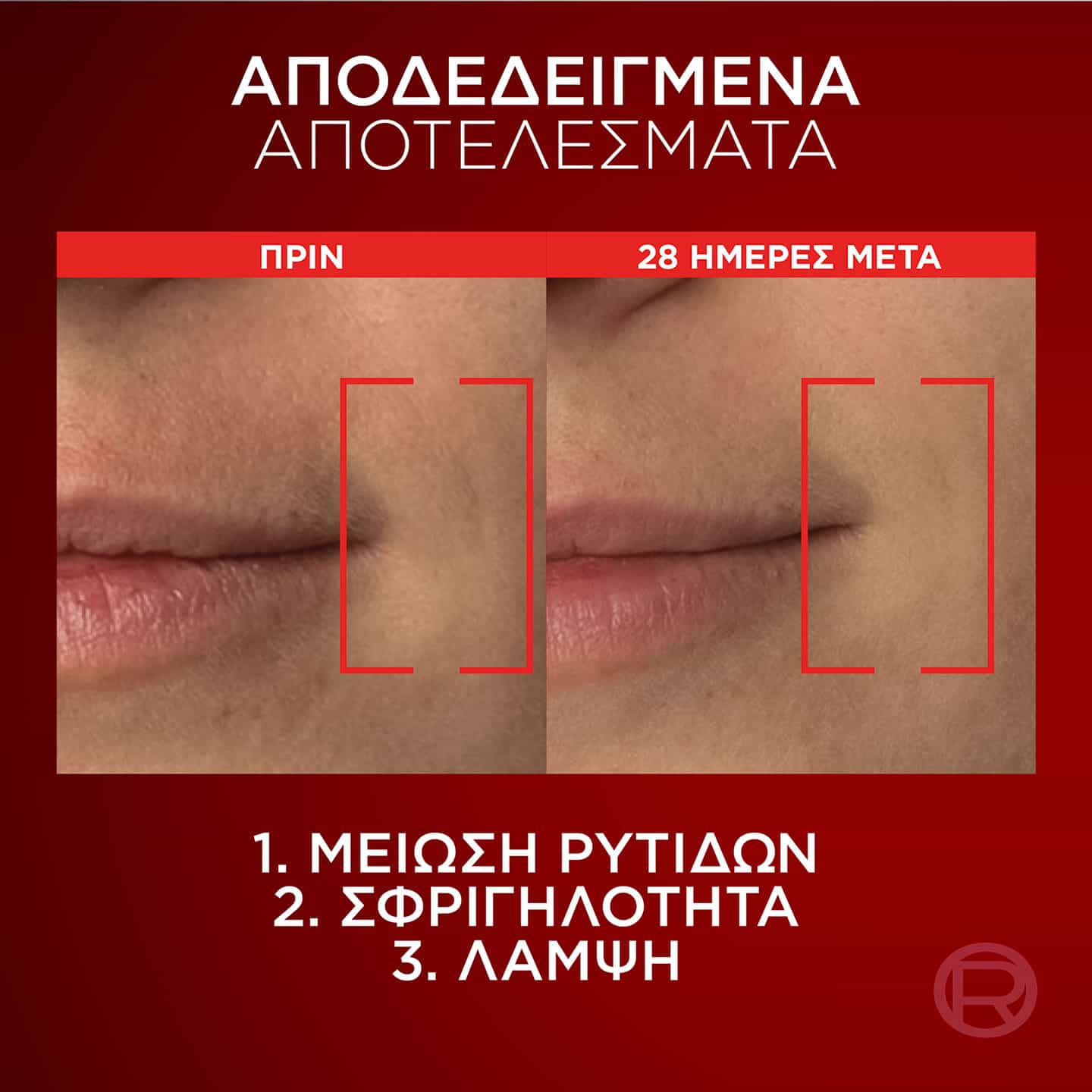 Revitalift Laser Κρέμα Ημέρας Τριπλής Δράσης Πριν & Μετά